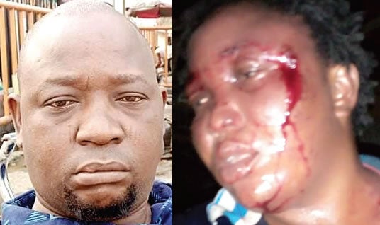 man beat wife post pictures facebook